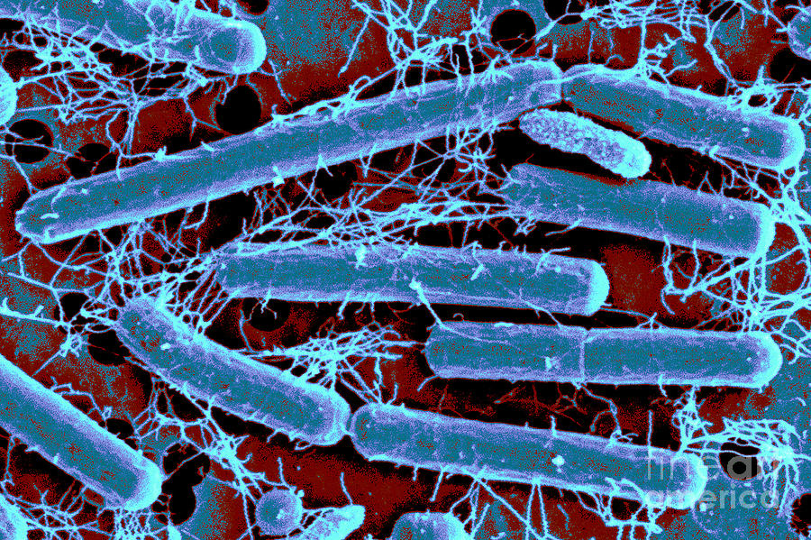 Lactobacillus Acidophilus pod elektronovým mikroskopem, zbarven modorfialově