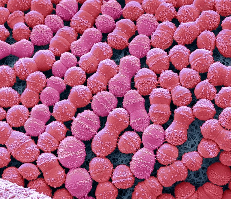 Streptococcus mutans_SEM